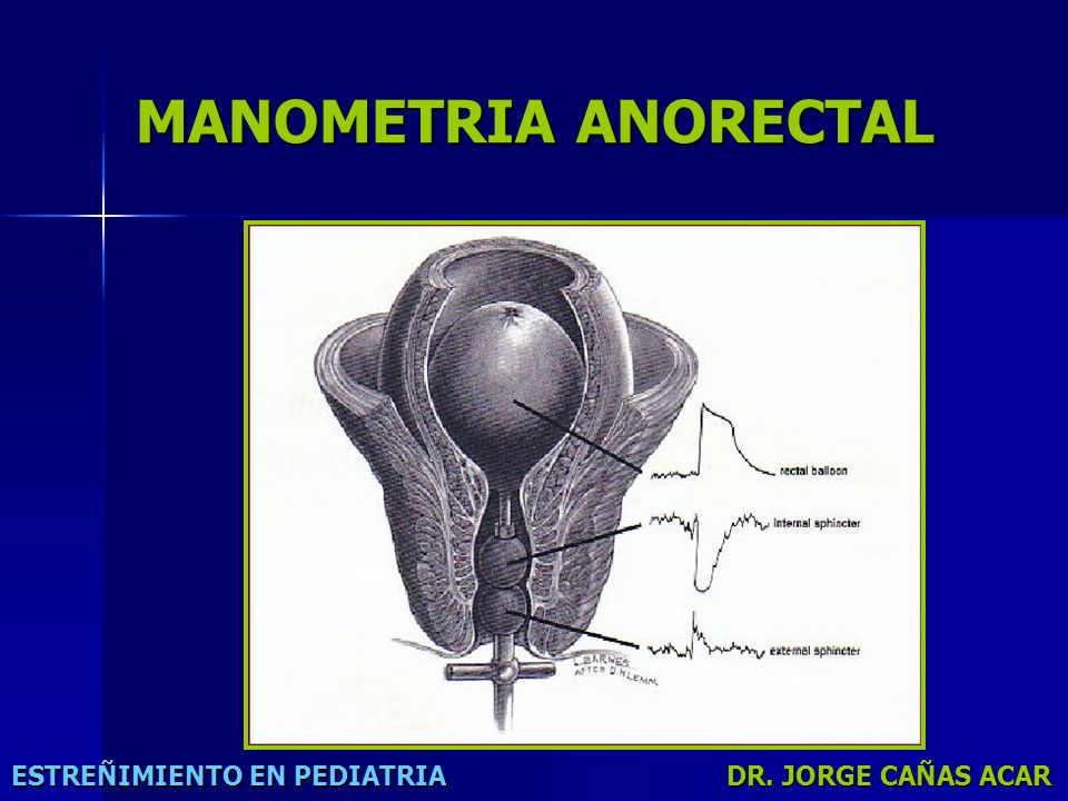 manometria anorectal